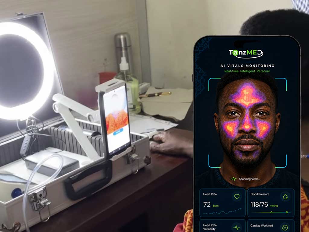 Tackling Cardiovascular Disease and Non-Communicable Diseases Through AI: TanzMED Launches Smartphone-Based Validation Study